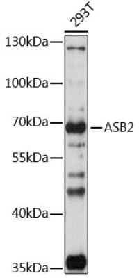 Western Blot: ASB2 AntibodyAzide and BSA Free [NBP2-92391]