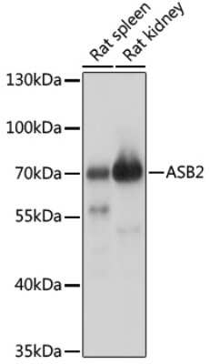 Western Blot: ASB2 AntibodyAzide and BSA Free [NBP2-92391]
