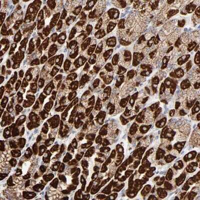 Immunohistochemistry-Paraffin: ASB3 Antibody [NBP1-88812]