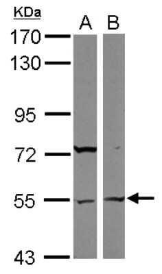 Western Blot: ASB3 Antibody [NBP2-15482]