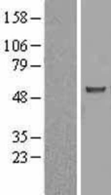 Western Blot: ASB3 Overexpression Lysate [NBL1-07750]