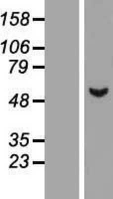 Western Blot: ASB3 Overexpression Lysate [NBL1-07751]