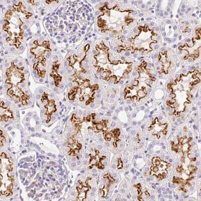 Immunohistochemistry-Paraffin: ASB4 Antibody [NBP2-49176]