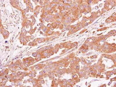 Immunohistochemistry-Paraffin: ASB4 Antibody [NBP1-32623]