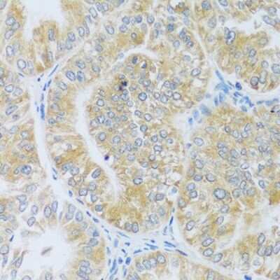 Immunohistochemistry-Paraffin: ASB4 Antibody - Azide and BSA Free [NBP3-04635]