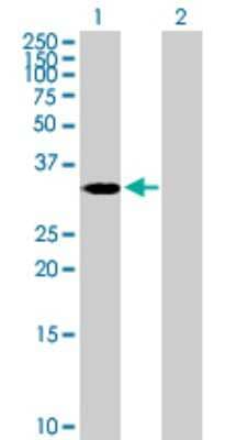 Western Blot: ASB4 Antibody [H00051666-B01P]