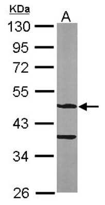 Western Blot: ASB4 Antibody [NBP1-32623]