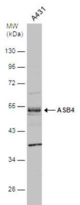 Western Blot: ASB4 Antibody [NBP1-32623]