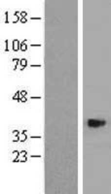 Western Blot: ASB4 Overexpression Lysate [NBP2-05448]