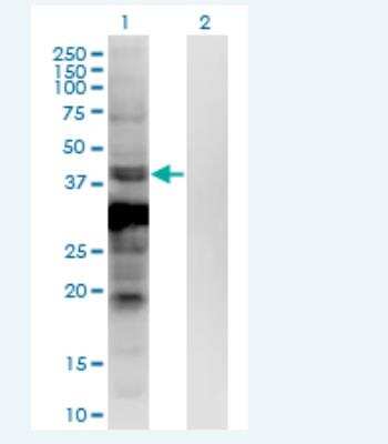 Western Blot: ASB5 Antibody (6B10) [H00140458-M03-100ug]