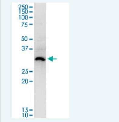 Western Blot: ASB5 Antibody (6B10) [H00140458-M03-100ug]