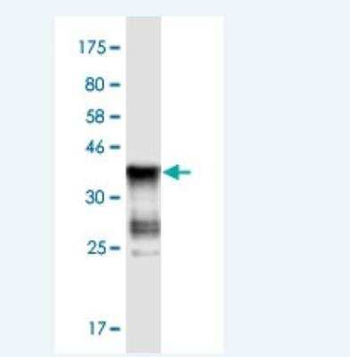 Western Blot: ASB5 Antibody (6B10) [H00140458-M03-100ug]