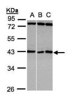 Western Blot: ASB5 Antibody [NBP1-32603]