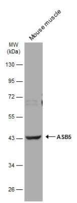 Western Blot: ASB5 Antibody [NBP1-32603]