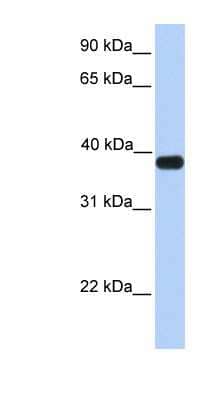 Western Blot: ASB5 Antibody [NBP1-59065]