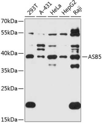 Western Blot: ASB5 AntibodyAzide and BSA Free [NBP2-92165]