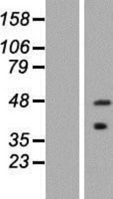 Western Blot: ASB5 Overexpression Lysate [NBP2-05747]