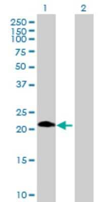 Western Blot: ASB6 Antibody [H00140459-B01P]