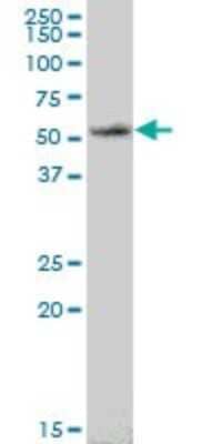 Western Blot: ASB6 Antibody [H00140459-B02P]