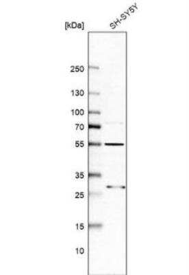 Western Blot: ASB6 Antibody [NBP1-86141]