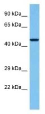 Western Blot: ASB6 Antibody [NBP3-10807]