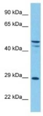 Western Blot: ASB6 Antibody [NBP3-10827]