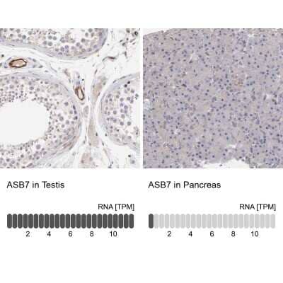 Immunohistochemistry-Paraffin: ASB7 Antibody [NBP1-86157]