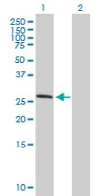 Western Blot: ASB7 Antibody [H00140460-B01P]