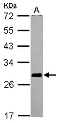 Western Blot: ASB7 Antibody [NBP2-15483]