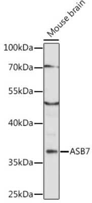 Western Blot: ASB7 AntibodyAzide and BSA Free [NBP2-92332]