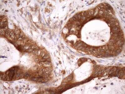 Immunohistochemistry: ASB8 Antibody (OTI3A12) [NBP2-46547]