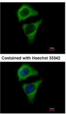 Immunocytochemistry/ Immunofluorescence: ASB8 Antibody [NBP2-15484]