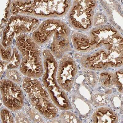 Immunohistochemistry-Paraffin: ASB8 Antibody [NBP1-83620]