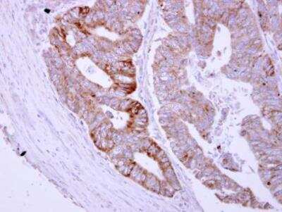 Immunohistochemistry-Paraffin: ASB8 Antibody [NBP2-15484]
