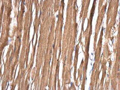 Immunohistochemistry-Paraffin: ASB8 Antibody [NBP2-15484]