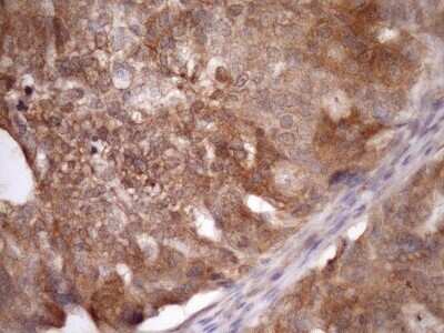 Immunohistochemistry: ASB8 Antibody (OTI3A12) - Azide and BSA Free [NBP2-72400]