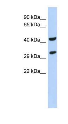 Western Blot: ASB8 Antibody [NBP1-58904]