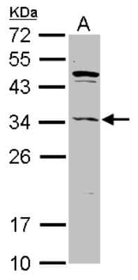 Western Blot: ASB8 Antibody [NBP2-15484]