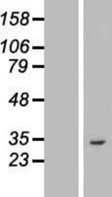 Western Blot: ASB8 Overexpression Lysate [NBL1-07755]