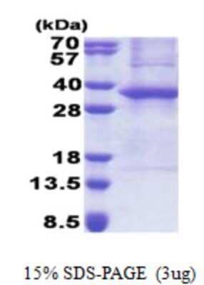 SDS-PAGE: Recombinant Human ASB8 His Protein [NBP2-22686]