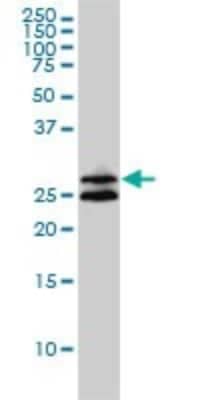 Western Blot: ASB9 Antibody (1D8) [H00140462-M01]