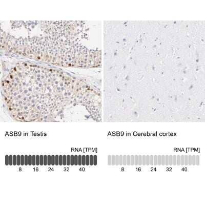 Immunohistochemistry-Paraffin: ASB9 Antibody [NBP1-85081]