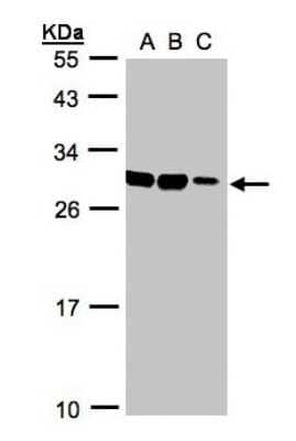 Western Blot: ASB9 Antibody [NBP1-32541]