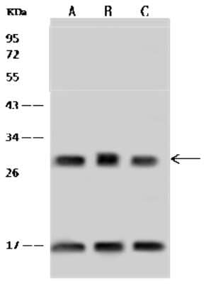 Western Blot: ASB9 Antibody [NBP2-98662]