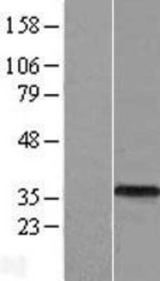 Western Blot: ASB9 Overexpression Lysate [NBL1-07756]