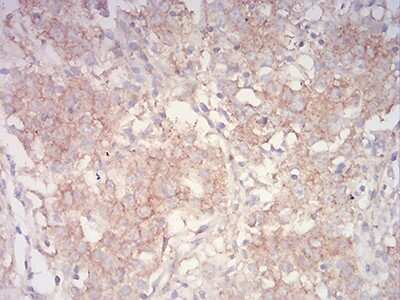 Immunohistochemistry-Paraffin: ASC/TMS1 Antibody (1C3D3) - BSA Free [NBP2-61676]