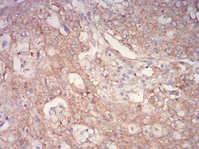 Immunohistochemistry-Paraffin: ASC/TMS1 Antibody (1C3D7) - BSA Free [NBP2-61682]