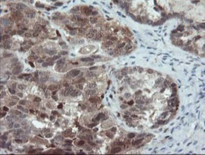 Immunohistochemistry-Paraffin: ASC/TMS1 Antibody (OTI3E9) [NBP2-03818]