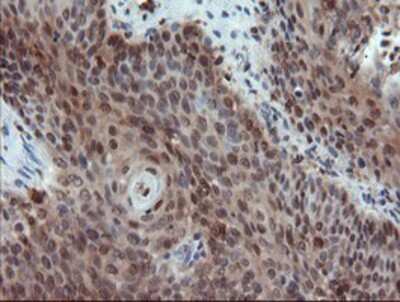 Immunohistochemistry-Paraffin: ASC/TMS1 Antibody (OTI3E9) [NBP2-03818]