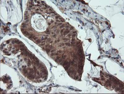 Immunohistochemistry-Paraffin: ASC/TMS1 Antibody (OTI3E9) [NBP2-03818]